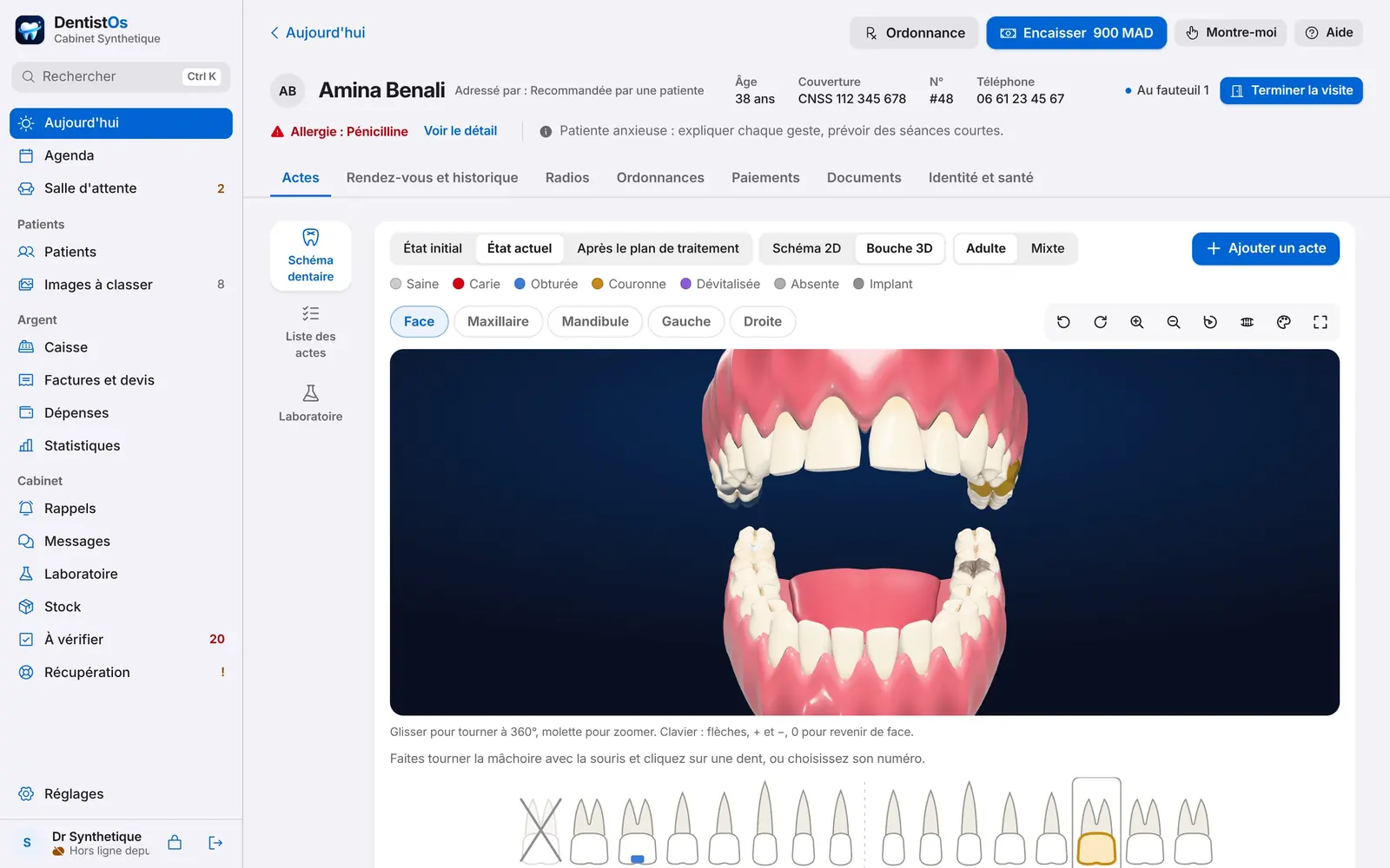 La bouche en 3D du dossier